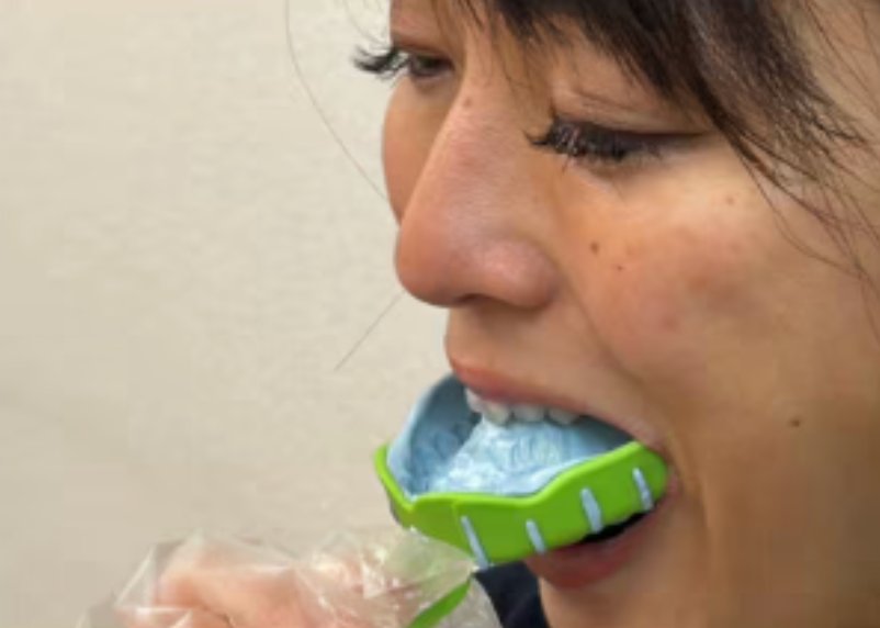 自宅で歯型を取る